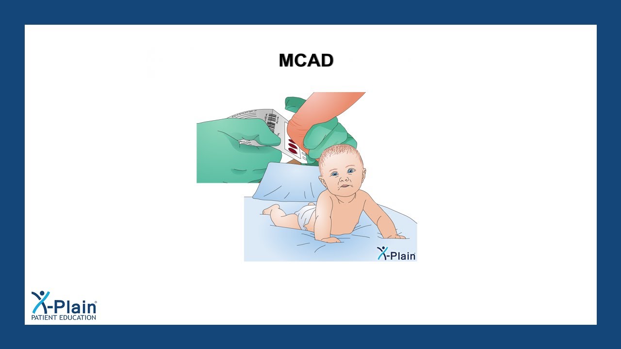 MCAD
