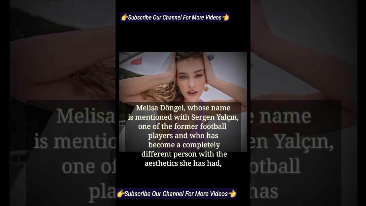 Melisa Döngel The Actress of kirli sepeti New Turkish Tv Series Talked about Her skin and Look