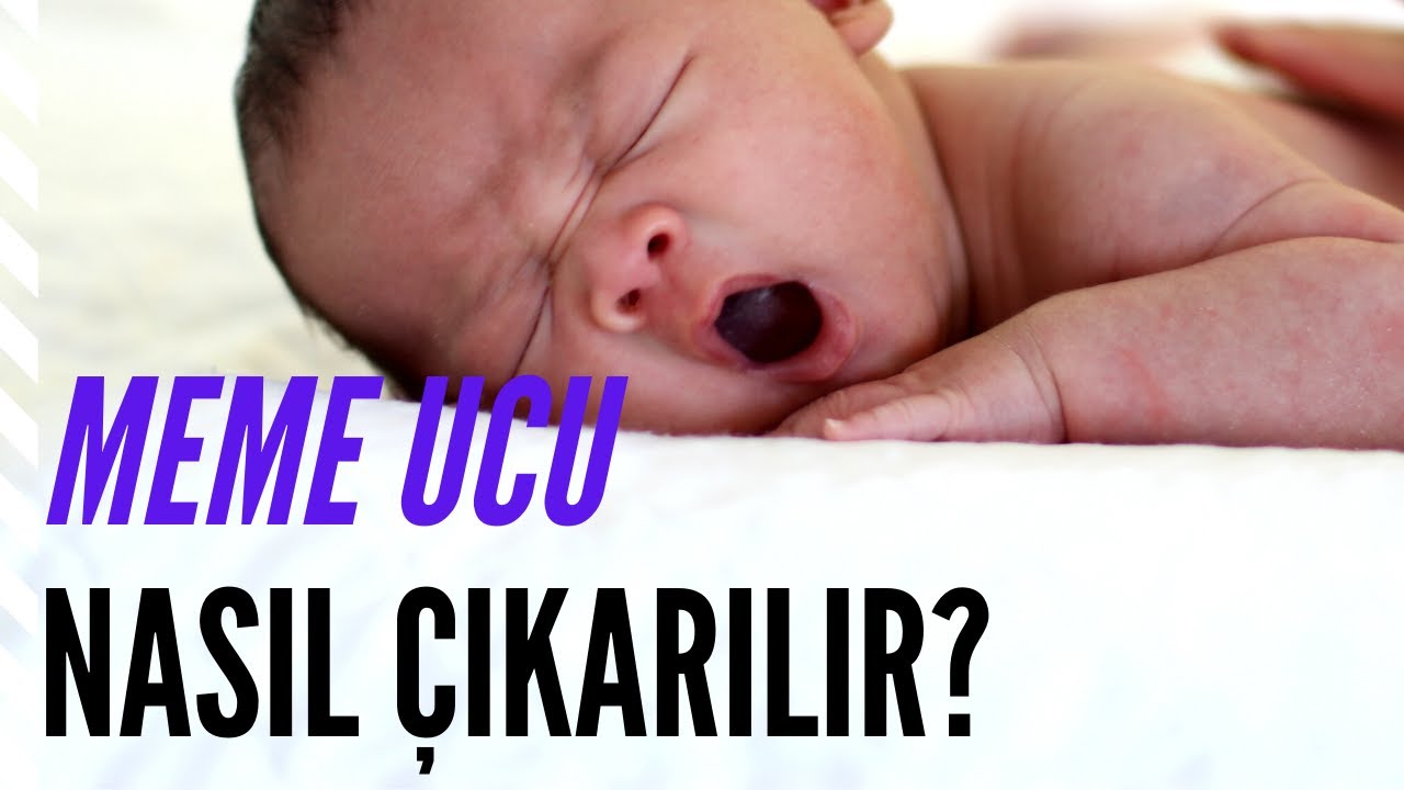 Meme Ucu Nasıl Çıkarılır - Dilruba Demirezer