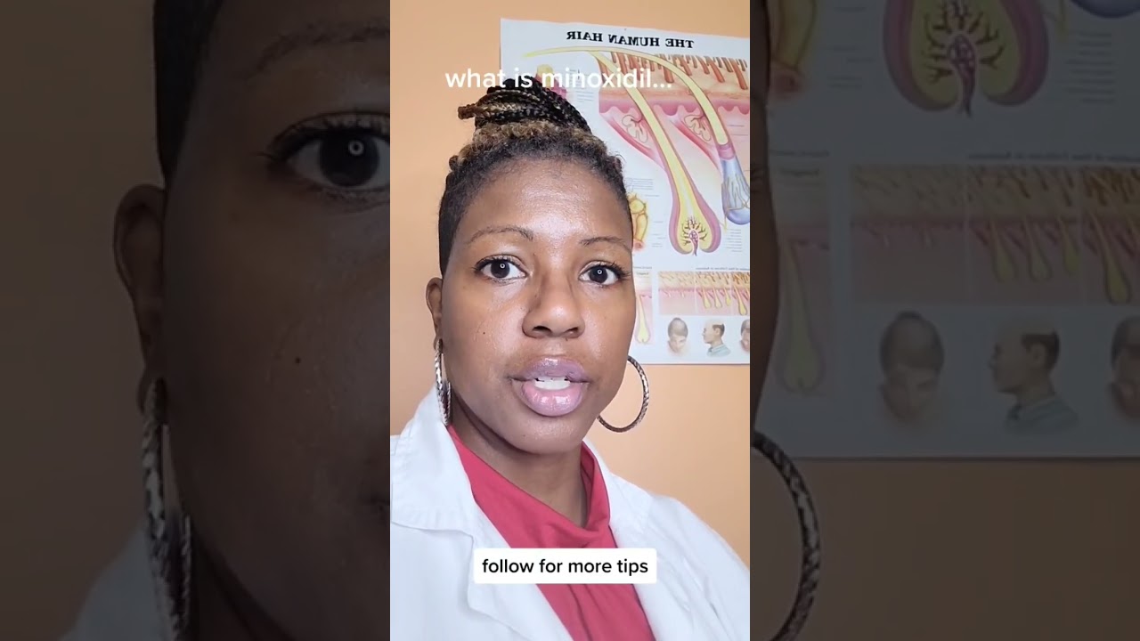 #minoxidil for hair loss in afro hair series pt 1 #Trichologist