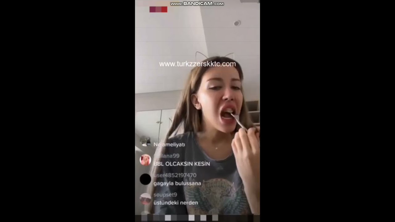 MİKA RAUN YANLIŞLIKLA MEMESİNİ AÇIYOR!!