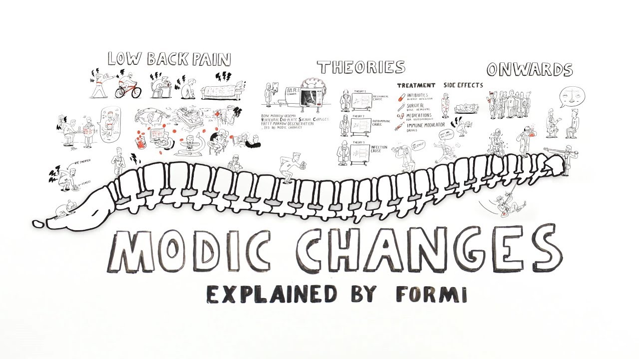 Modic Changes - Explained by FORMI