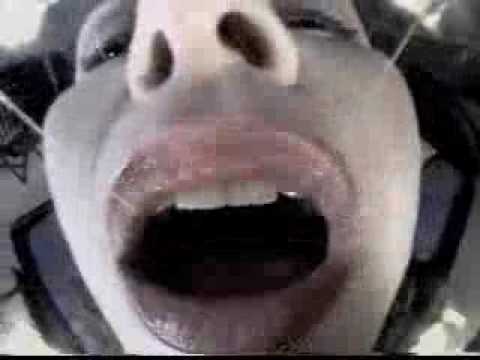 Mouthcam Sheila