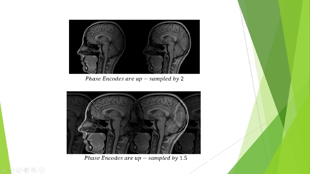 Muhammet Talha Uyar - Visualizing the Effects of Changes in k-space to an Image