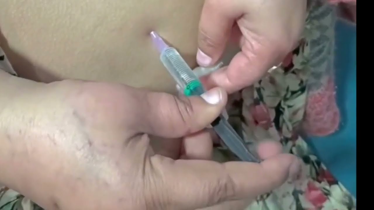 Multani Family Vlog | Injection On Buttock | Best Procedure of Intramuscular 💉 😎 | Naughty Doctor