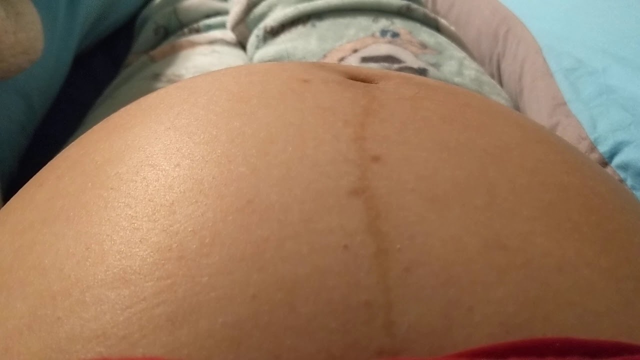 My belly looks like a water bed lol