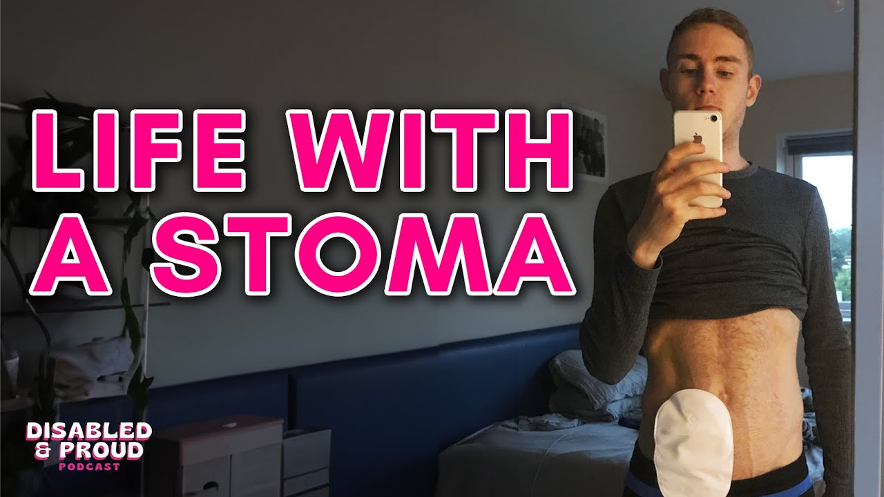 My Stoma Saved My Life - with Adam Fare