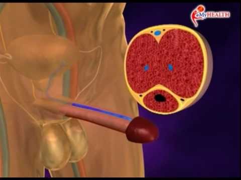 MyHEALTH : Mati Pucuk