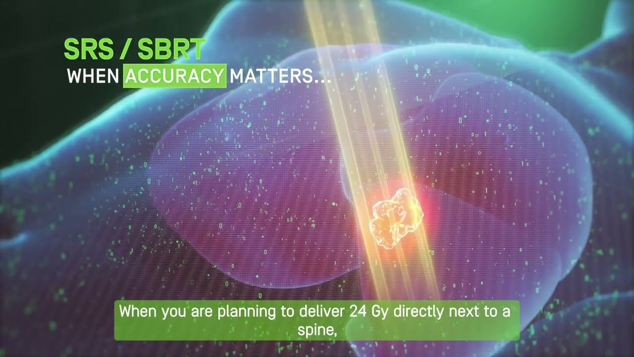 myQA SRS is the perfect complement to myQA iON, your secondary dose check calculation software