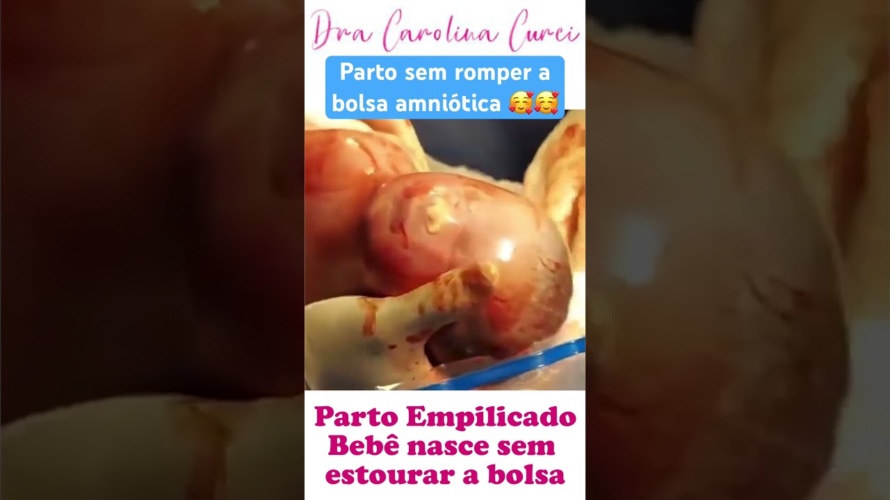 Nasceu sem romper a bolsa ! #parto #gestacao #mamae #bebe