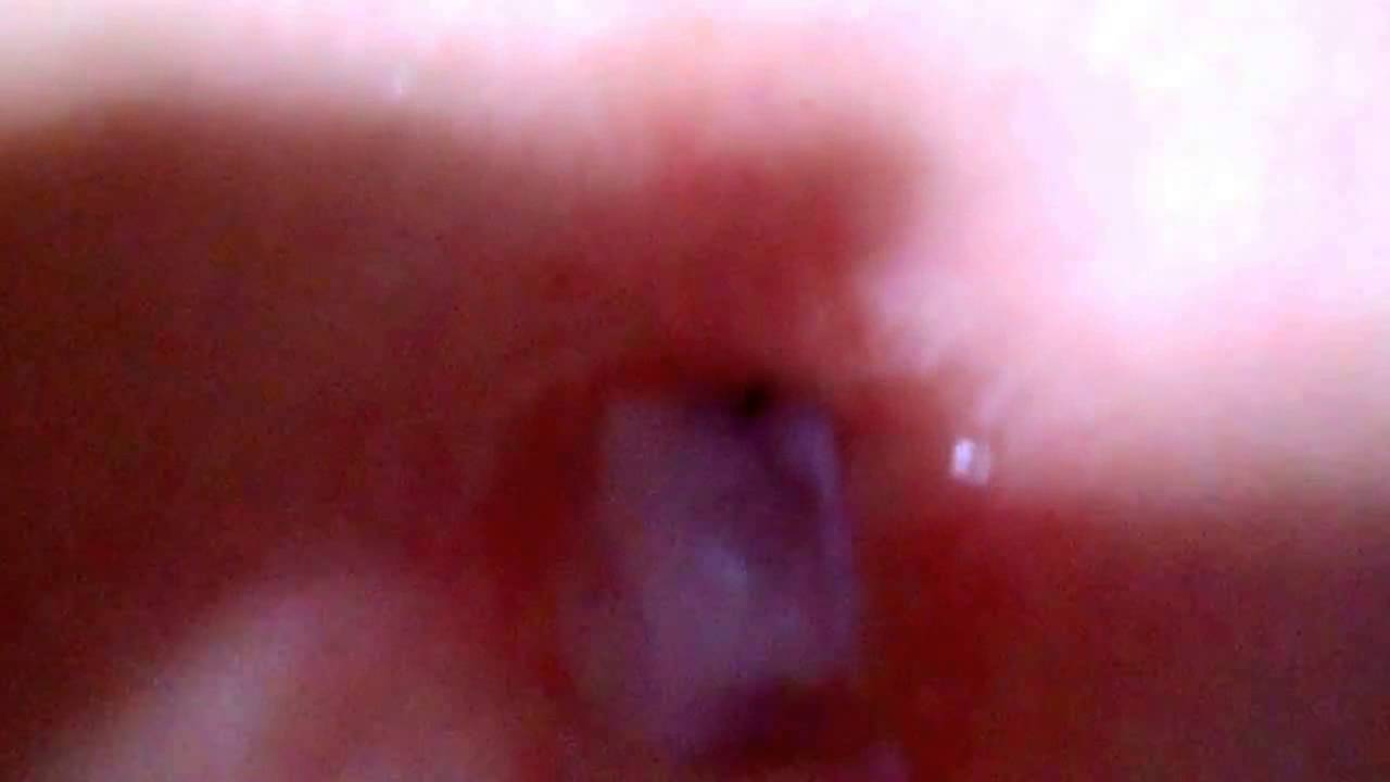 おへそ　氷　navel ice 2