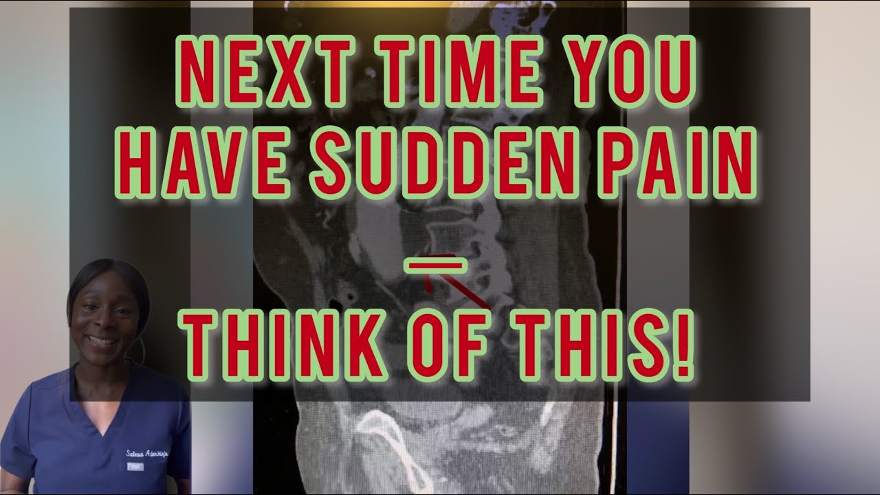 Next time you have SUDDEN PAIN, think of this - “MAJOR PAYNE” AAA (Abdominal Aortic Aneurysm) series