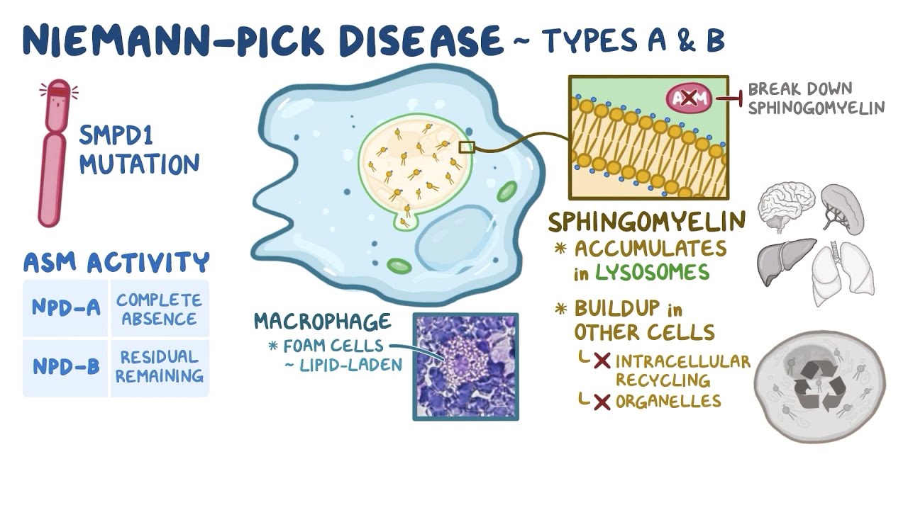 Niemann-Pick Disease Types A & B: Causes, Symptoms, and Treatment