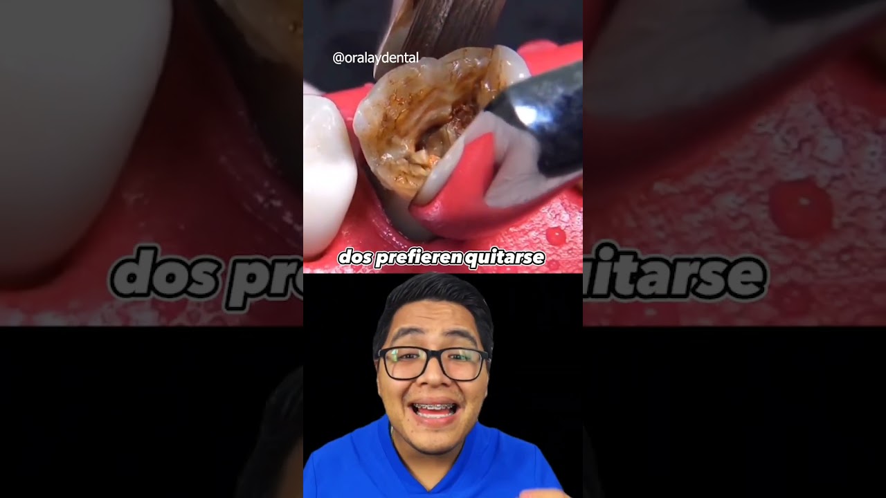 nunca te saques muelas #dientes #dentista #tips #parati #viral #fyp #shorts #shortvideo #fypシ