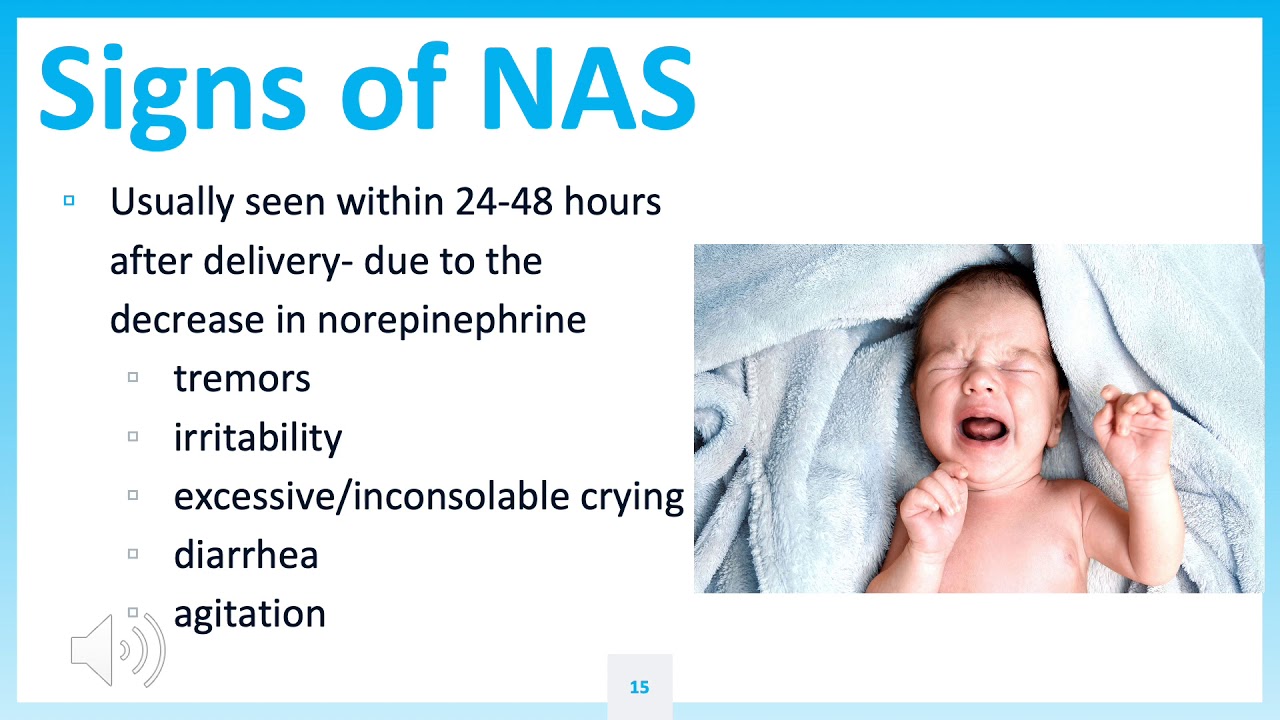 NURS 444: GroganK NAS Clinical Presentation