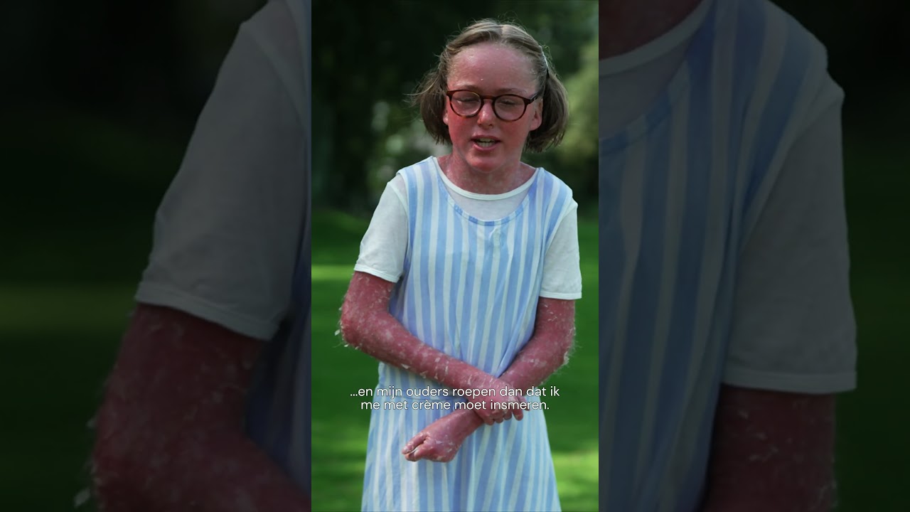 Nynke heeft Ichtyosis met Confetti - Je Zal Het Maar Hebben Jr. #JZHMH #IchtyosisMetConfetti #Huid