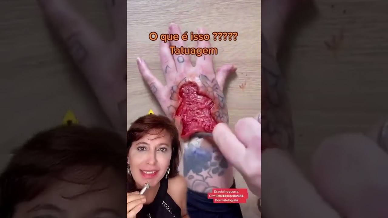 O que é isso ????  Tatuagem ???