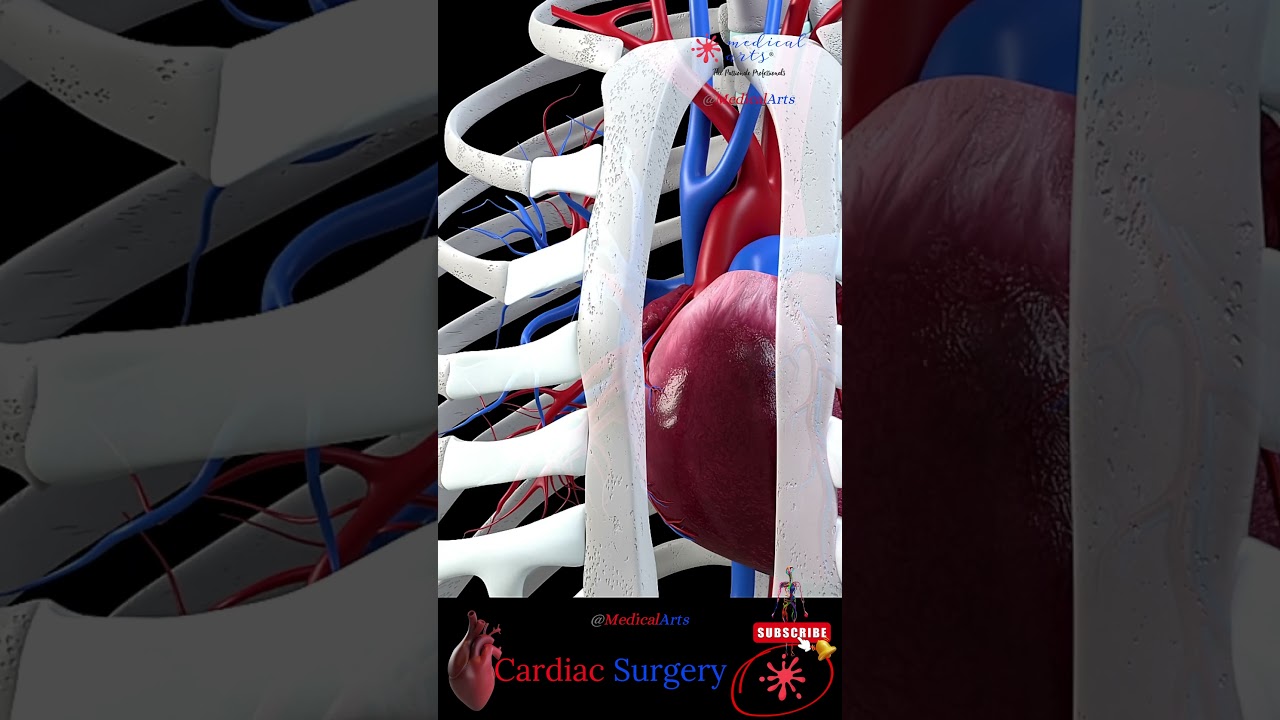 Open Heart 🔪 Cardiac Surgery ╭❤️～ Heart Bypass || 3D Medical Animation