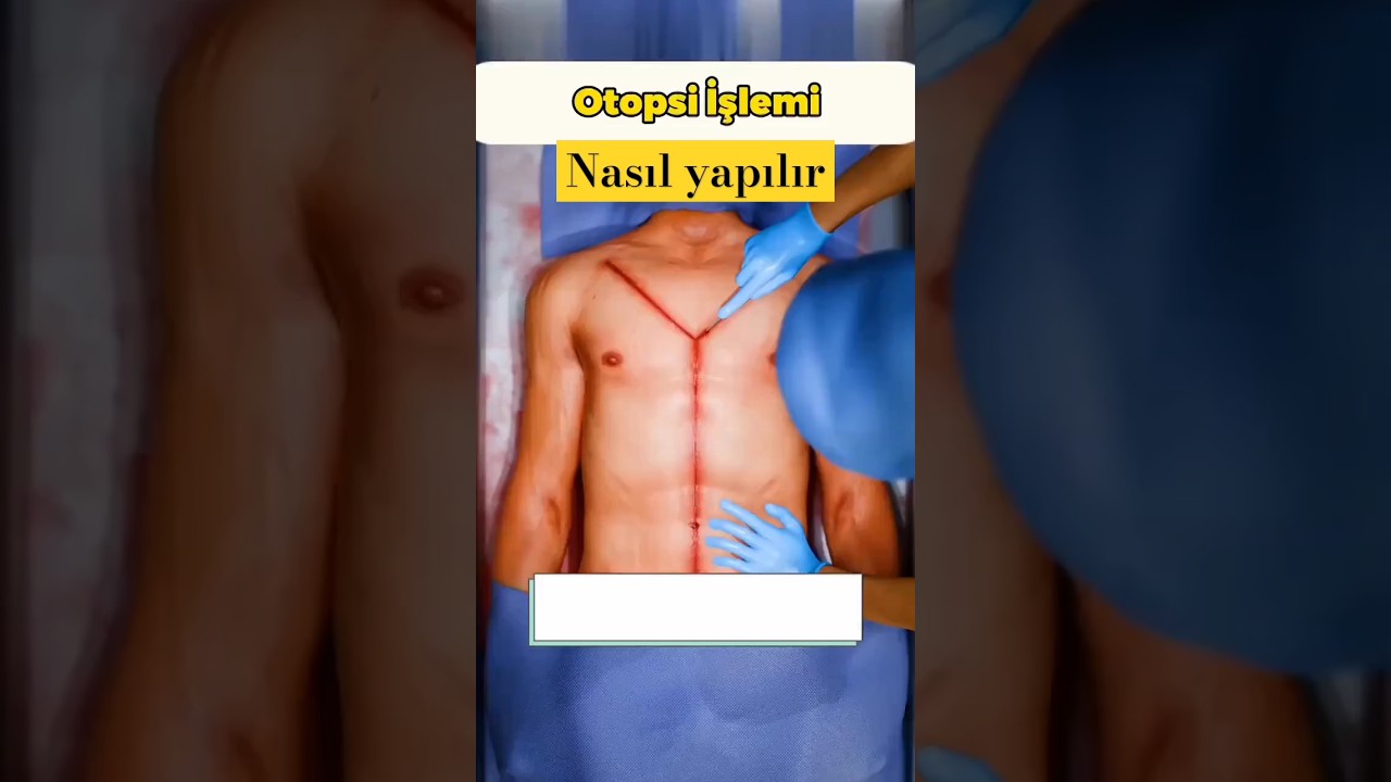 Otopsi Nasıl Yapılır? #keşfet #keşfetteyiz #shortvideo #shortsvideo #shortsviral