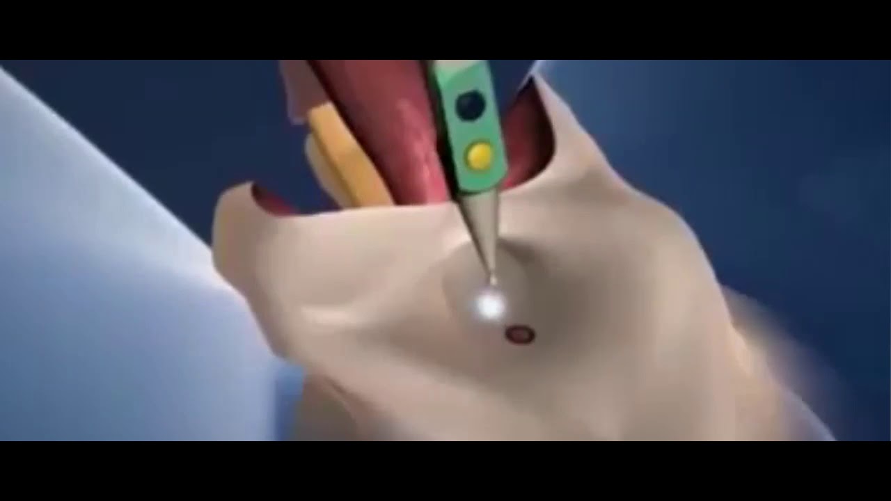 PAANO MAGING GIRL ANG ISANG BOY/GENDER REASSIGNMENT PROCEDURE/ANIMATION