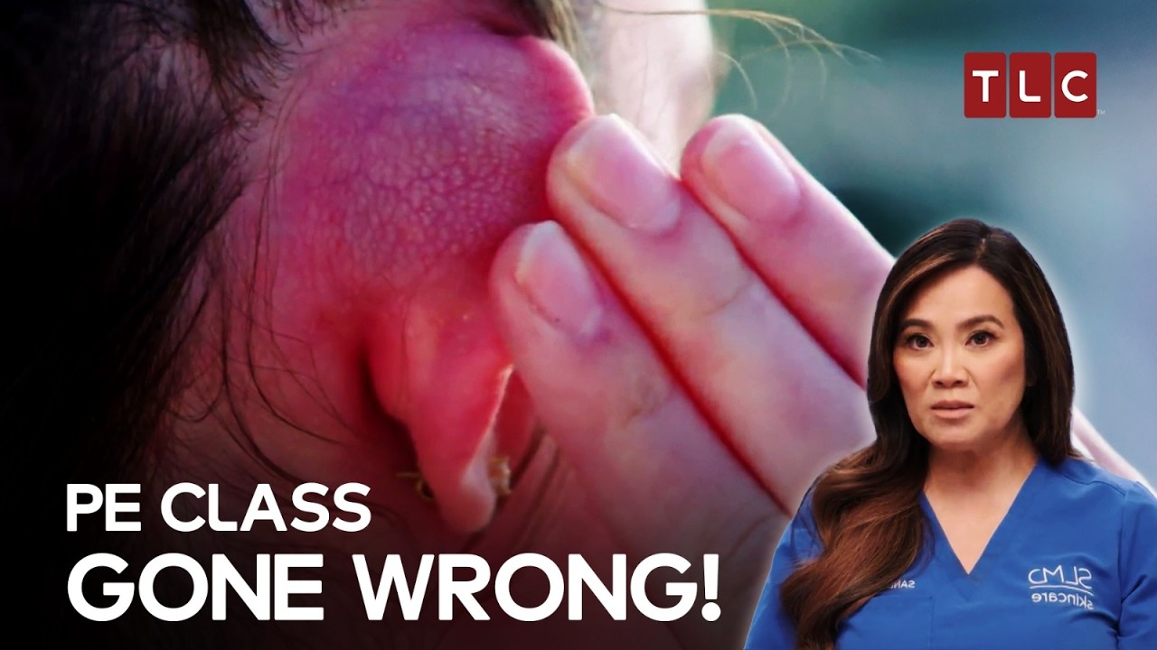 PE Lesson Led to Lifelong Insecurity! | Dr Pimple Popper TLC