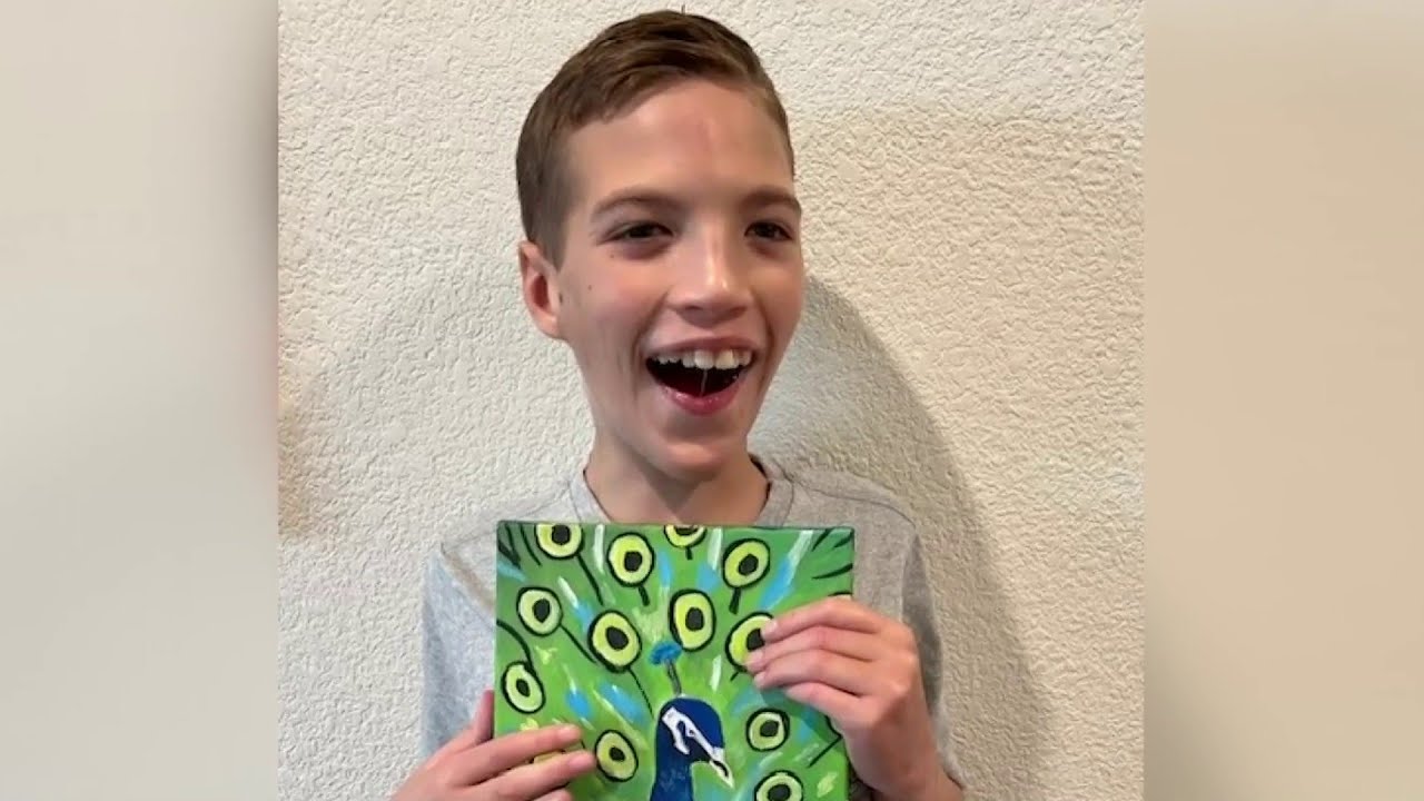 Peacock bring joy to boy with Cri du Chat