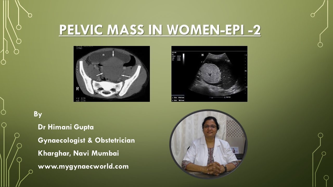 Pelvic Mass in Females- Causes in Prepubertal Girls,Benign & Malignant ( Video series- Epi-2)