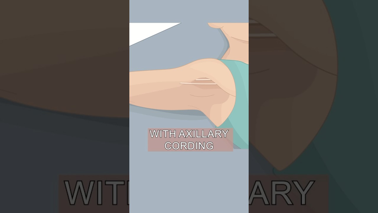 Penjelasan tentang Tali Ketiak