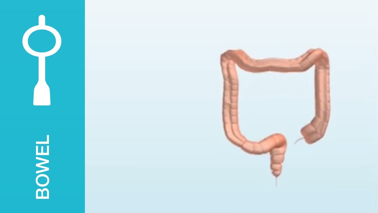 Peristeen - scintographics showing the bowel before and after Peristeen use