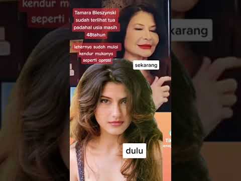 Perubahan Mencolok..!! Wajah Tamara Blezinsky Dulu dan Sekarang