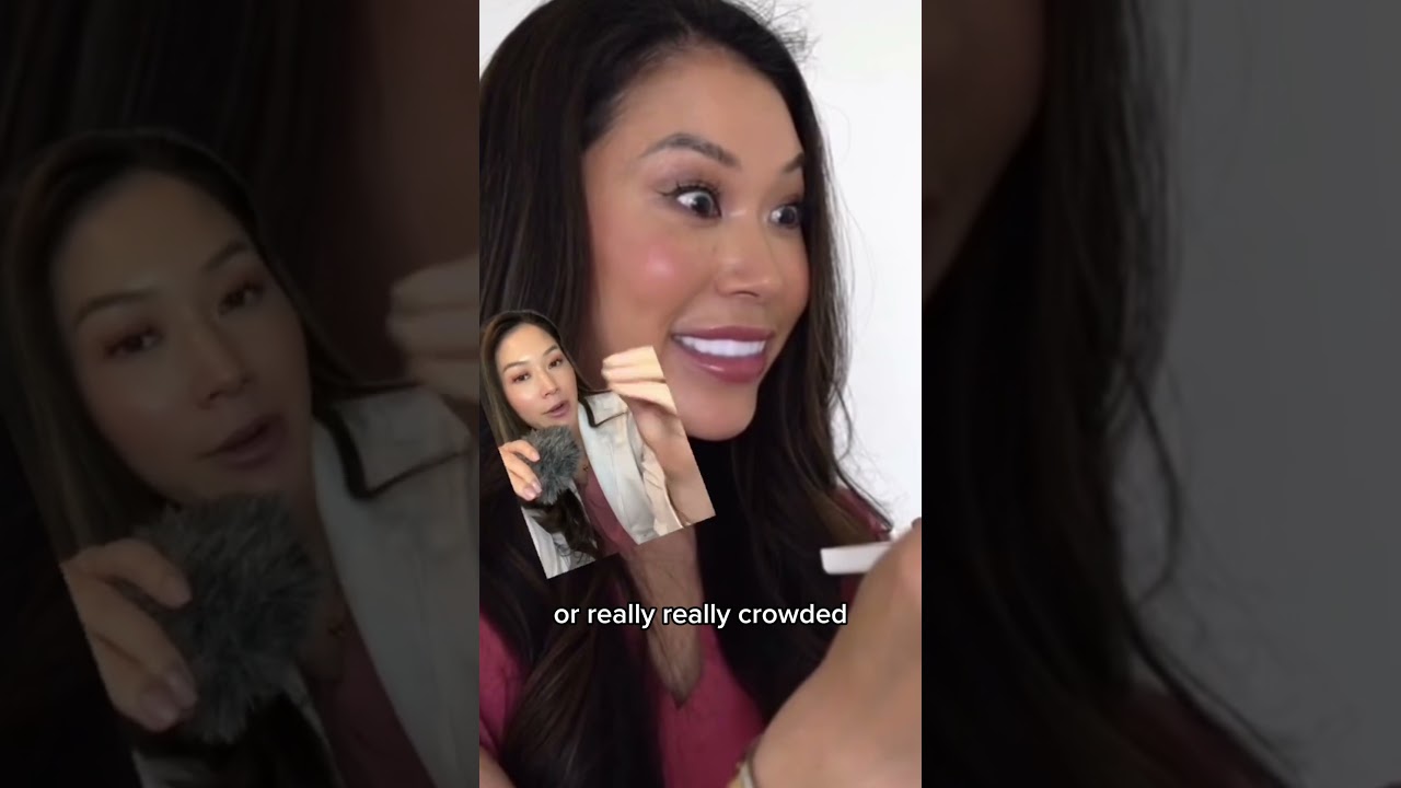 Pop on veneers review. #veneer #veneers #dentist #mailinveneers