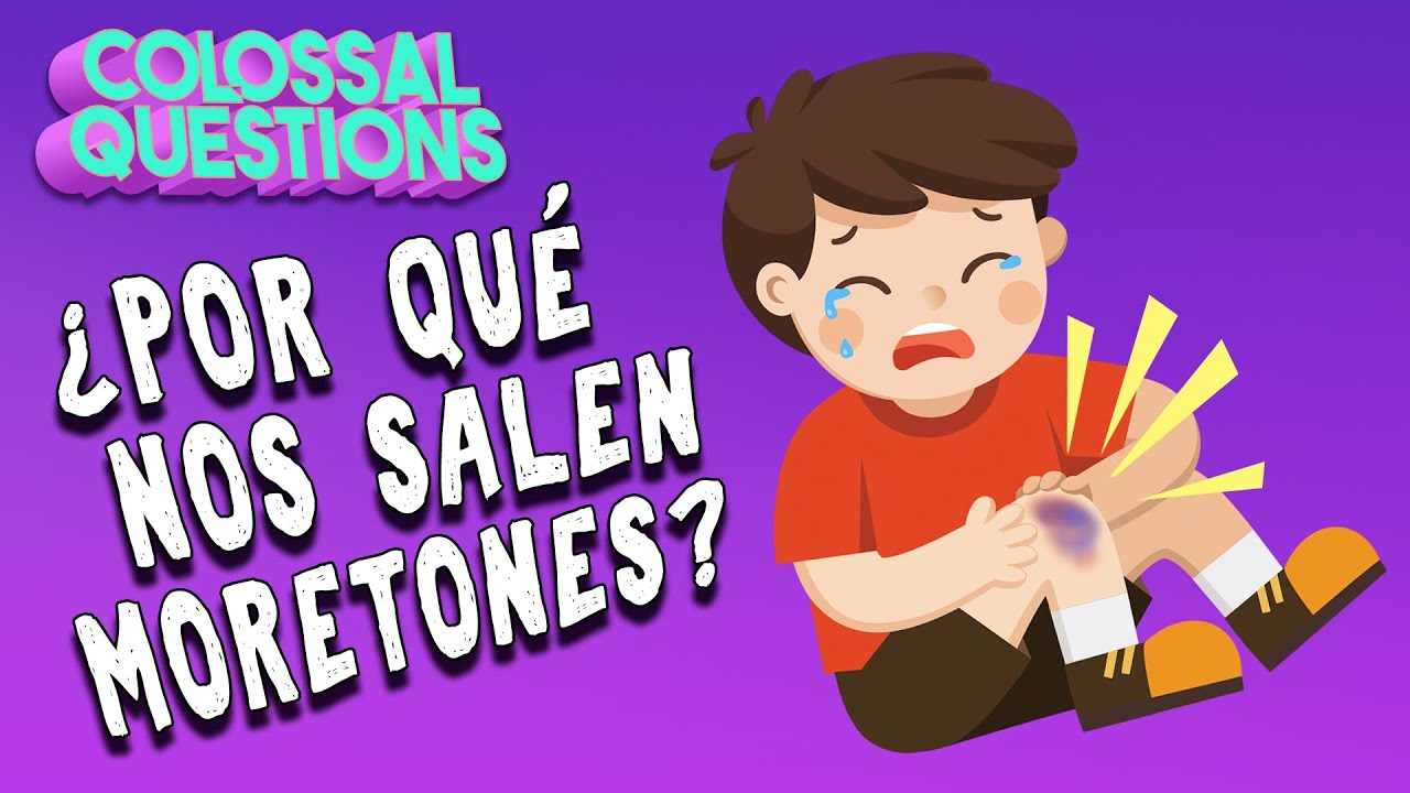 ¿Por qué nos salen moretones? | PREGUNTAS COLOSALES