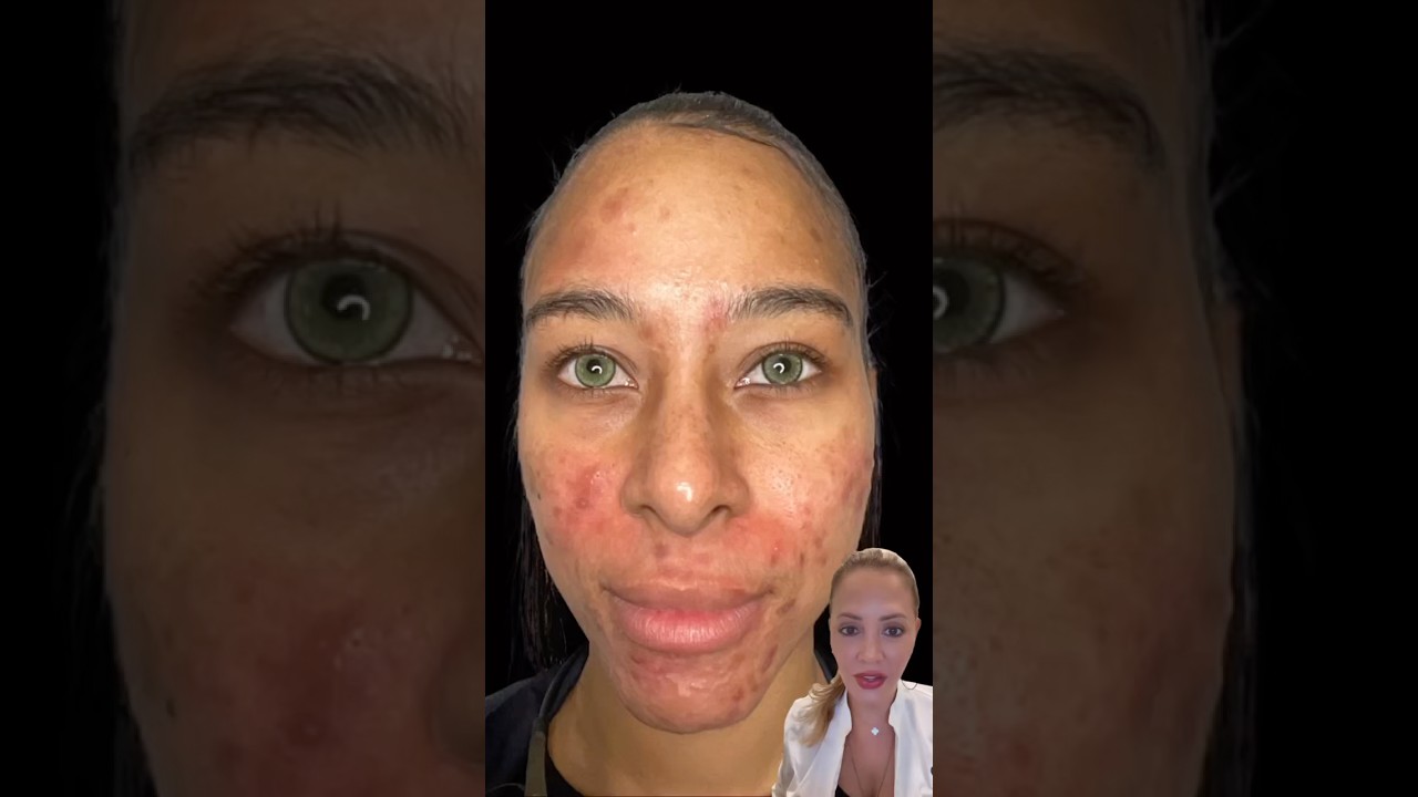 Power Of Skin Saint Products💪