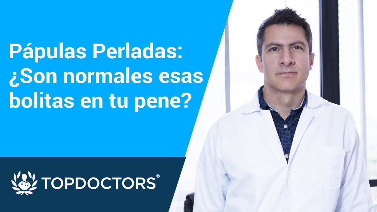 Pápulas perladas: ¿Son normales esas bolitas en tu pene?