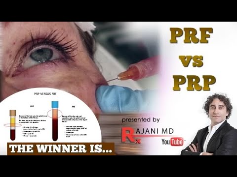 PRF vs PRP  Head to Head Comparison -The First Study