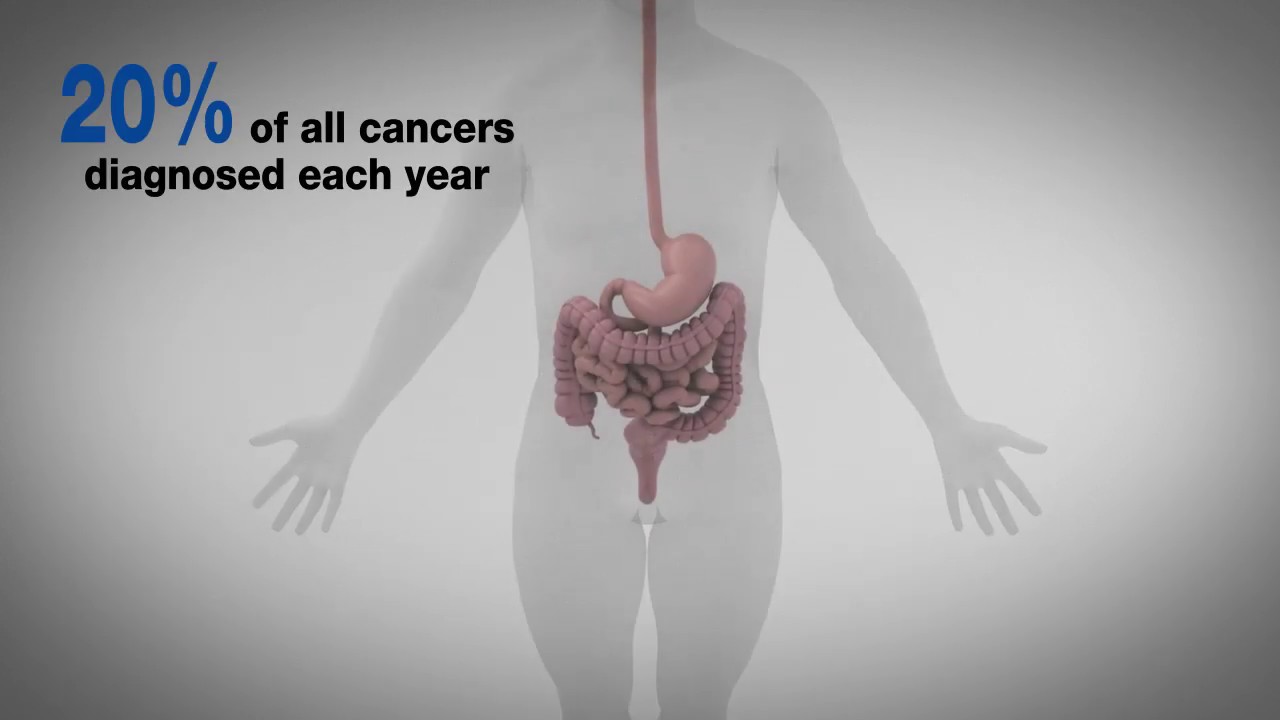 Progress in Treating Rare Cancers: ASCO's 2019 Advance of the Year