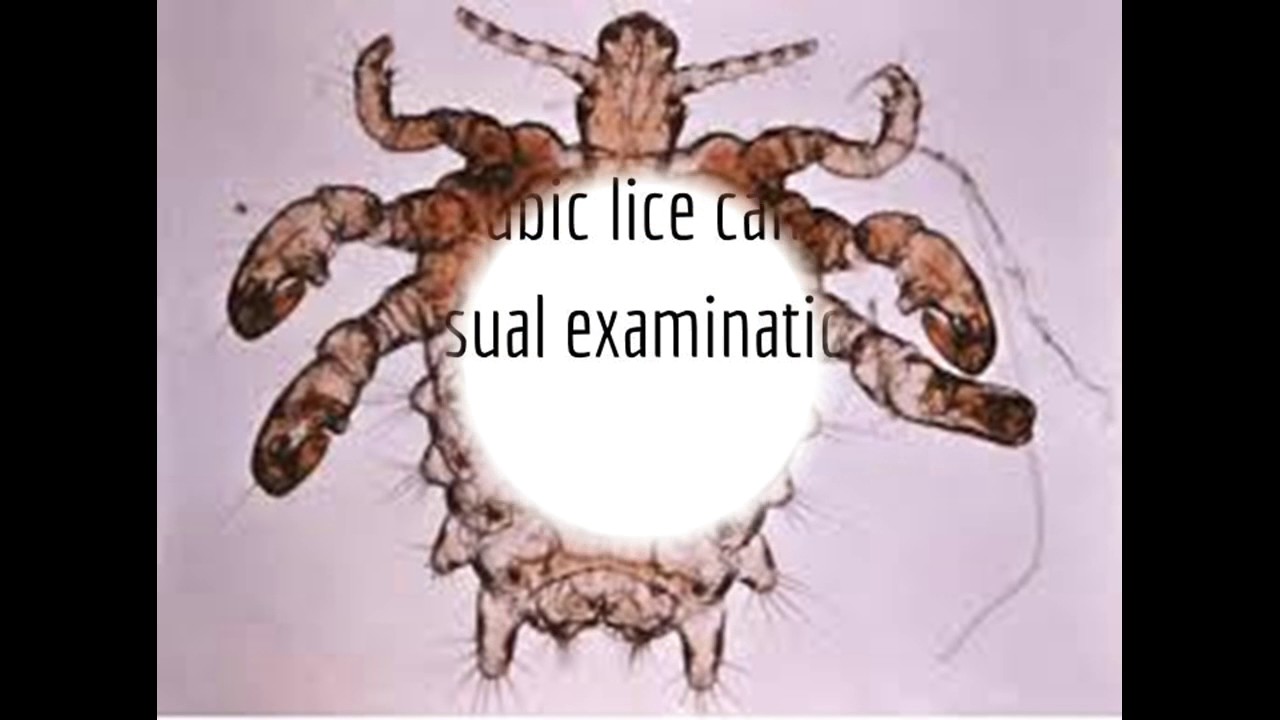 Pubic Lice by Jessica and Lam