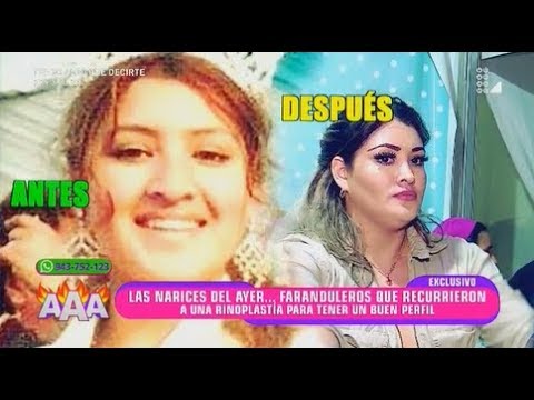 ¡QUE TALES TRANSFORMACIONES! LAS NARICES MAS FALSAS DE LA FARANDULA