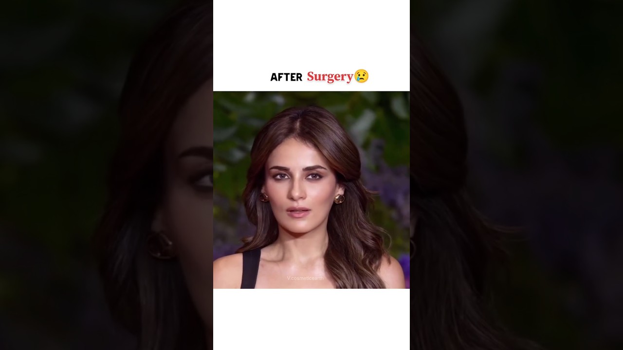 Radhika madan after surgery😢💔#shorts #radhikamadan #bollywood #transformation #plasticsurgery