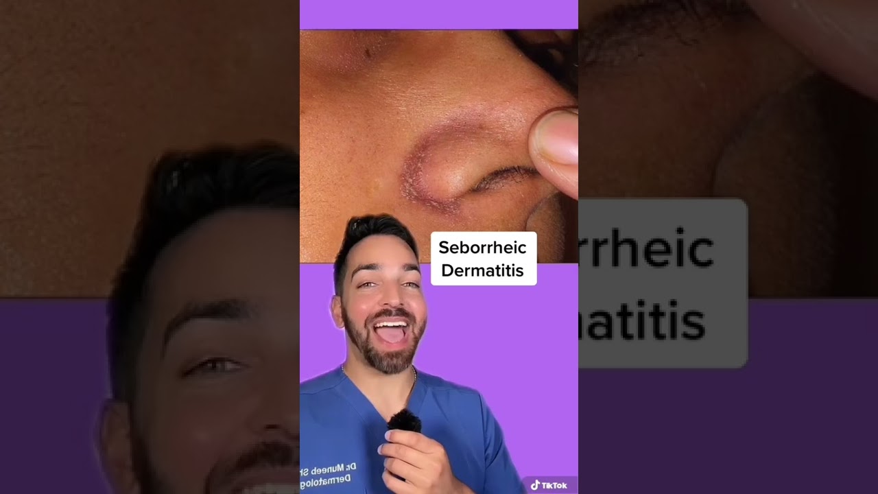 Redness and Flaking Along the Nose? 👃 | Doctorly #shorts