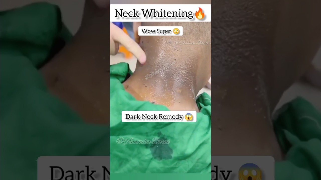 Remove Neck Darkness In 10 Mins😱 #shorts #skincare #darkneck #beautytips #ytshorts Anamika Barai
