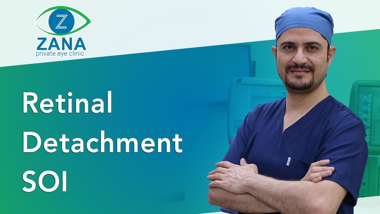 Retinal Detachment SOI