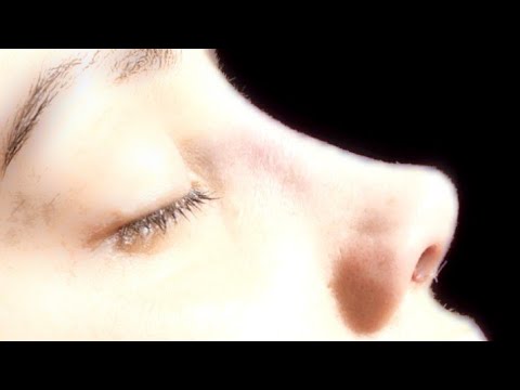 Rhinoplasty Subliminal | Burun Estetik Ameliyatı
