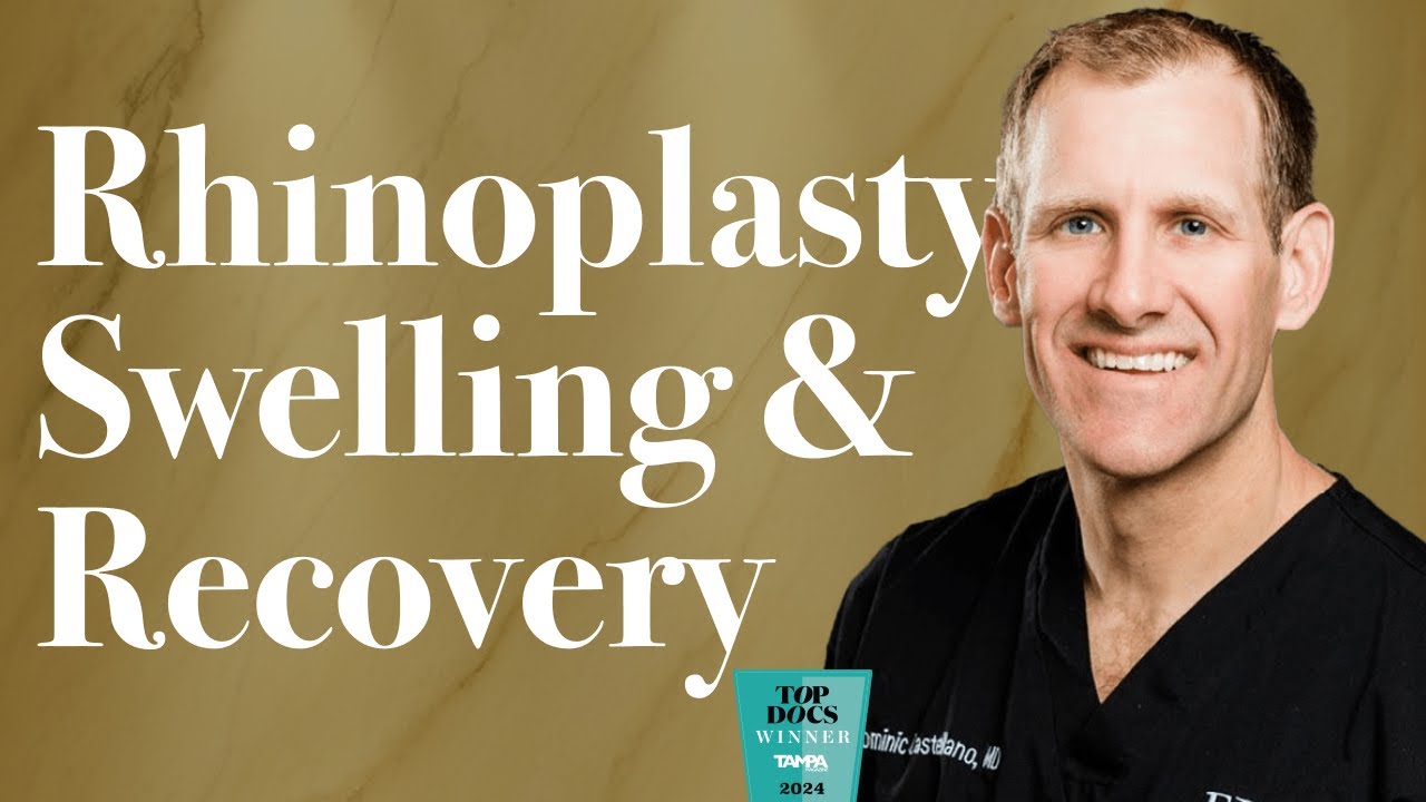 Rhinoplasty Swelling Stages And Recovery