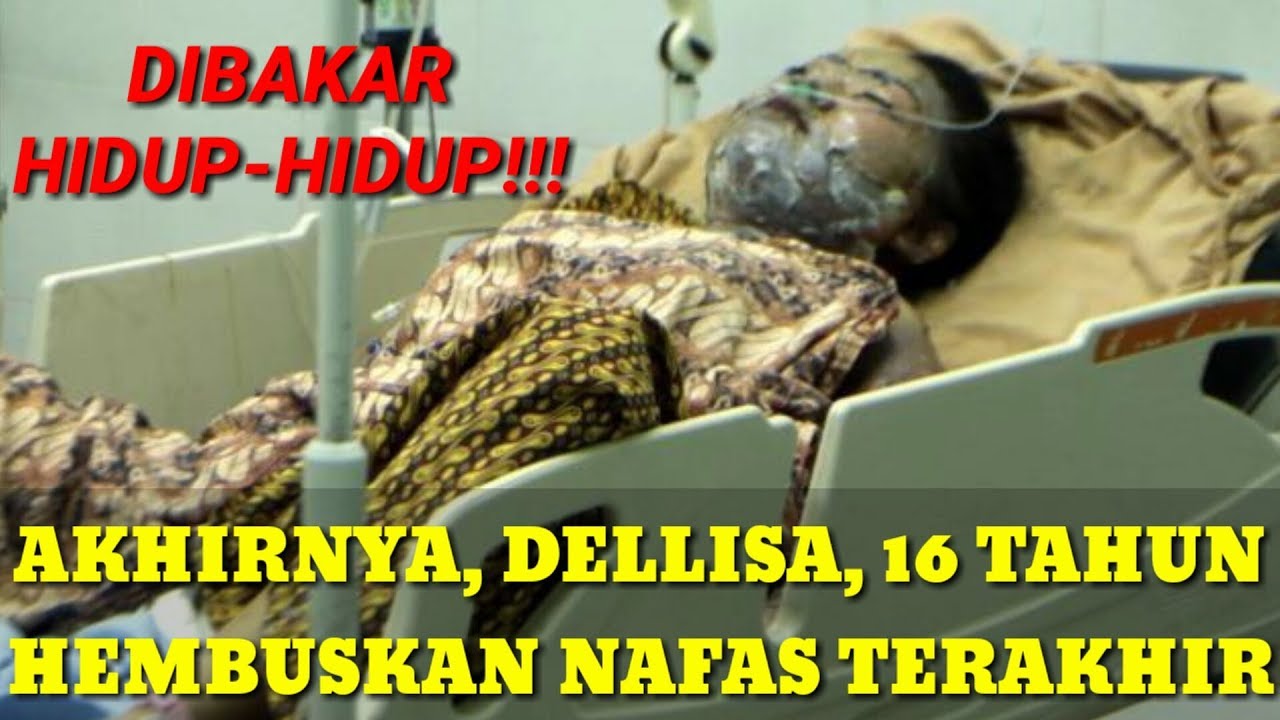 RIP DELLISA AYU LATIFA [remaja 16 tahun dibakar hidup-hidup oleh pacar sendiri]
