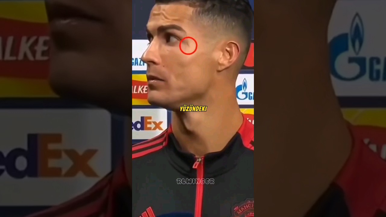 RONALDO'NUN YÜZÜNDEKI YARA İZİ NEDEN VAR 🤯😱 #shorts #short #football #ronaldo
