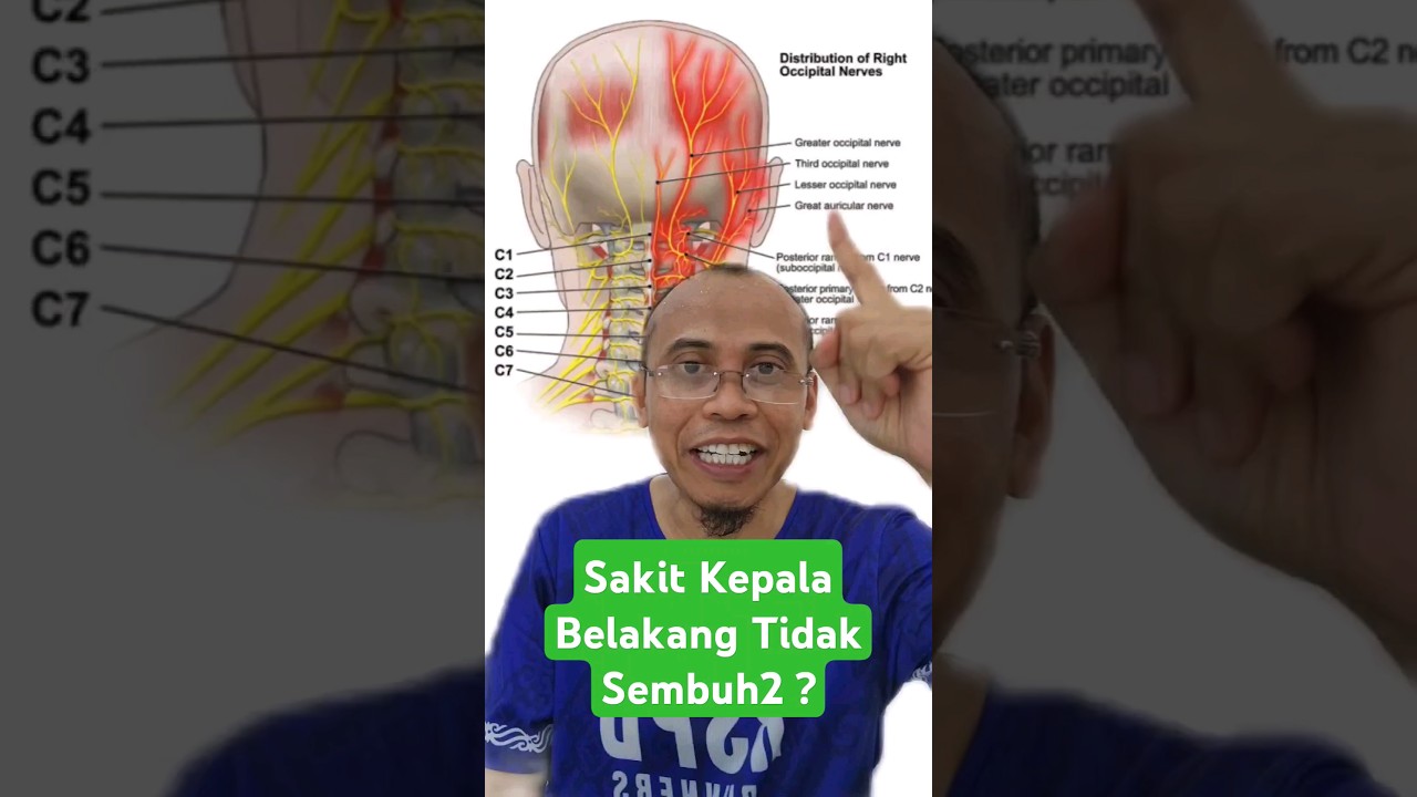 Sakit Kepala Belakang tidak sembuh2? #sakit kepala  #sarafkejepit #doktersaraf