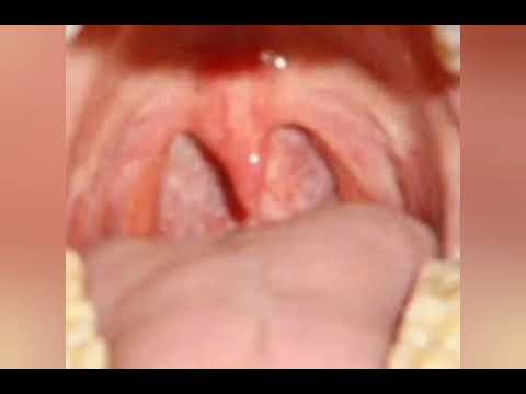 sam sparks vore clips