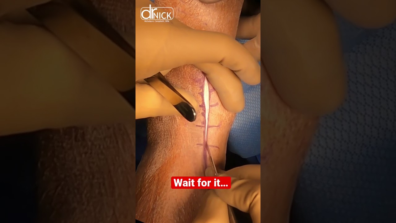 Satisfying incision making! #shorts #satisfying