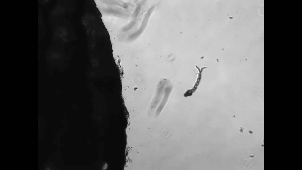 Schistosoma Mansoni  Cercariae Penetrating Human Flesh!